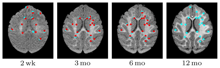 Fig. 15