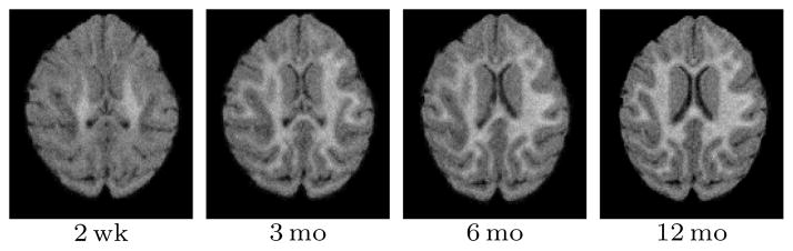 Fig. 10