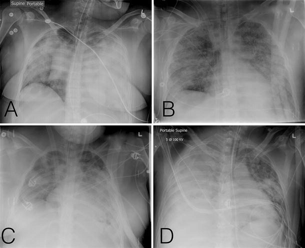 Fig. 1