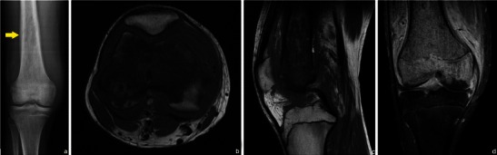 Fig. 29