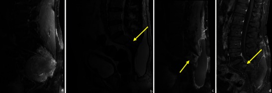 Fig. 26