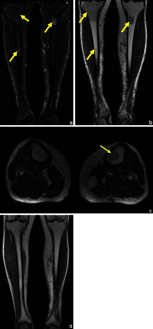 Fig. 35