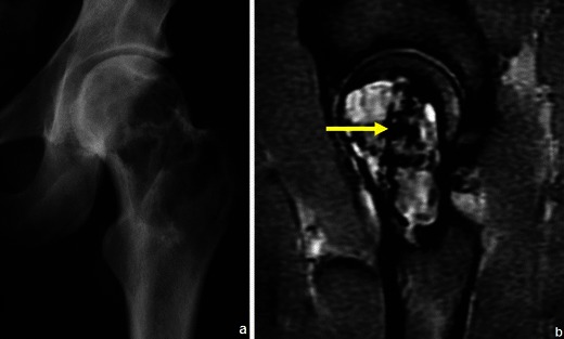 Fig. 16