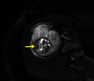 Fig. 17