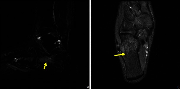 Fig. 32