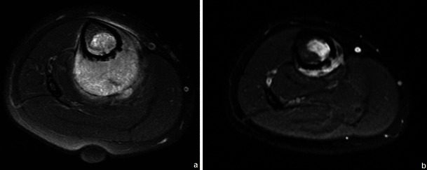 Fig. 25