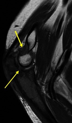 Fig. 21