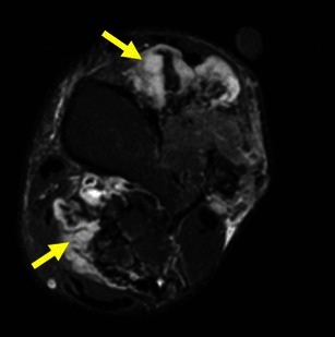 Fig. 13