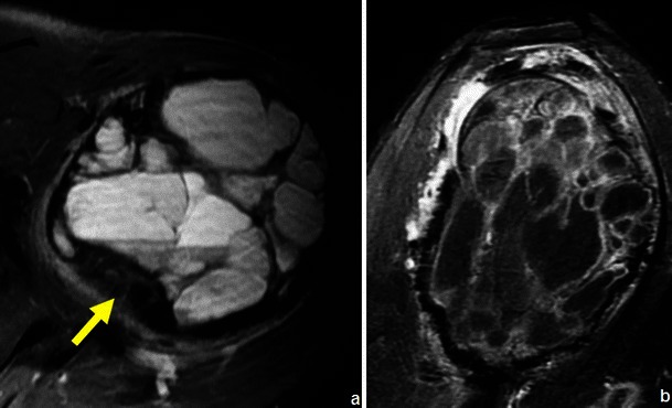 Fig. 15