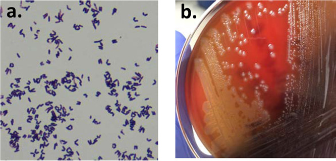 FIG 2