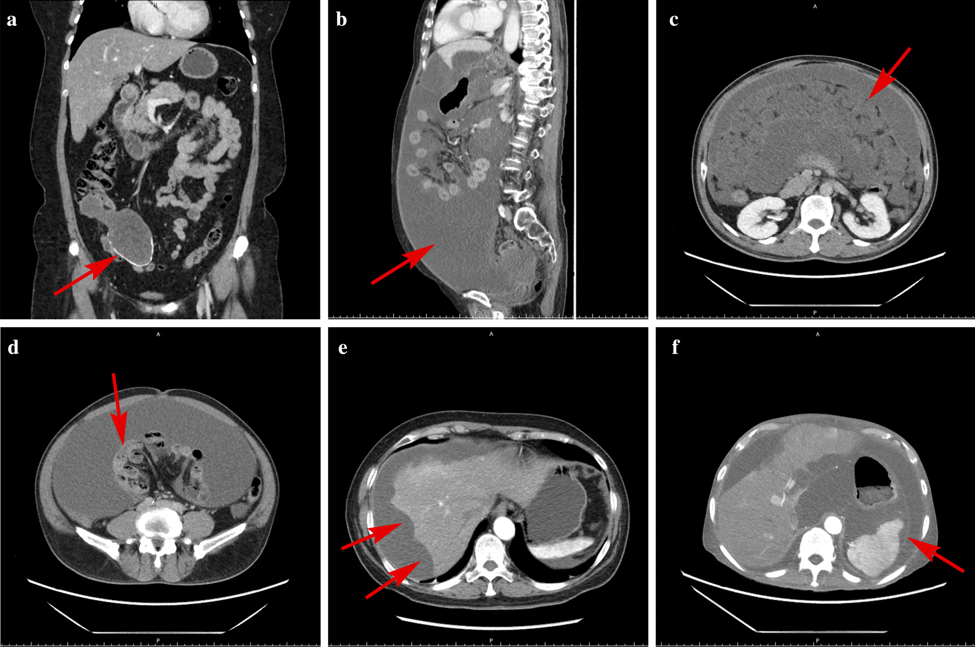 Fig. 4