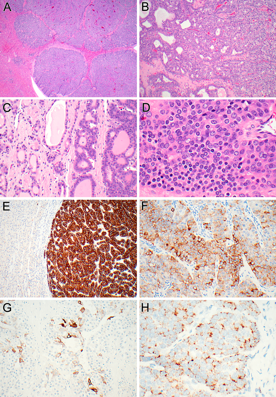 Figure 3 (Case 1):