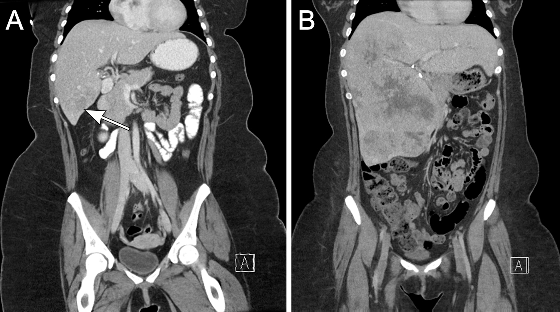 Figure 1 (Case 1):