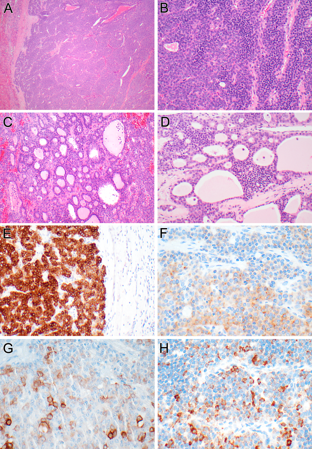 Figure 4 (Case 2):