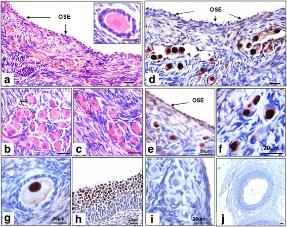 Fig. 11