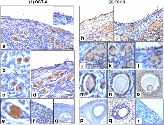 Fig. 12