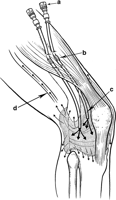 Fig. 2