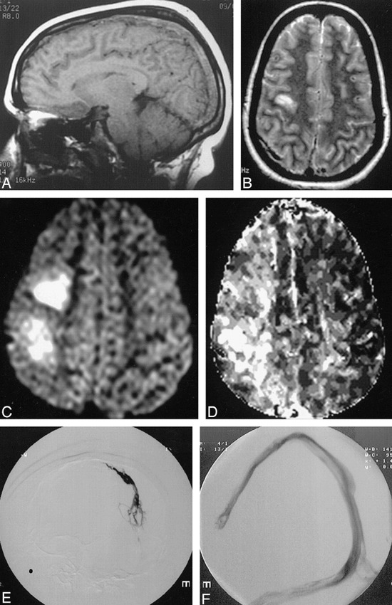 fig 1.