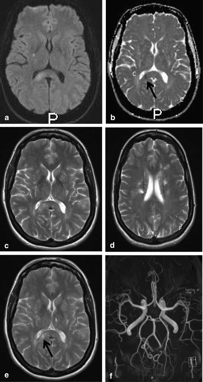 Fig. 15