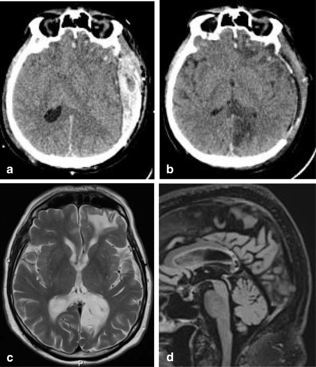 Fig. 17