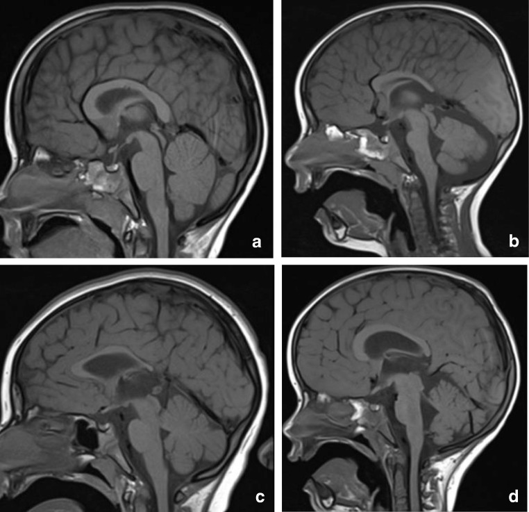 Fig. 13