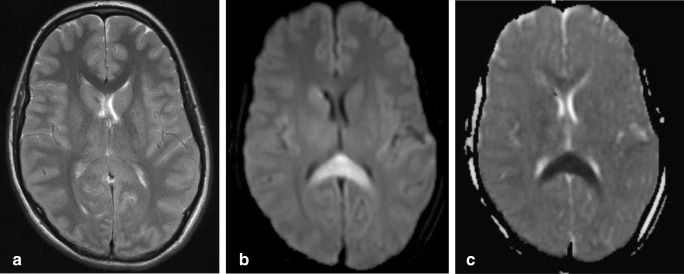 Fig. 16