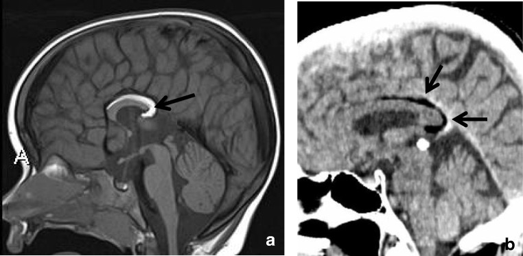 Fig. 14