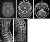 Fig. 12