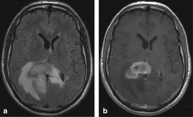 Fig. 11