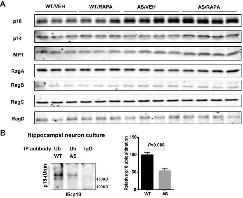 Figure 3—figure supplement 1.