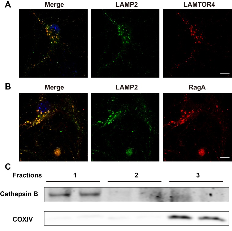 Figure 2—figure supplement 1.