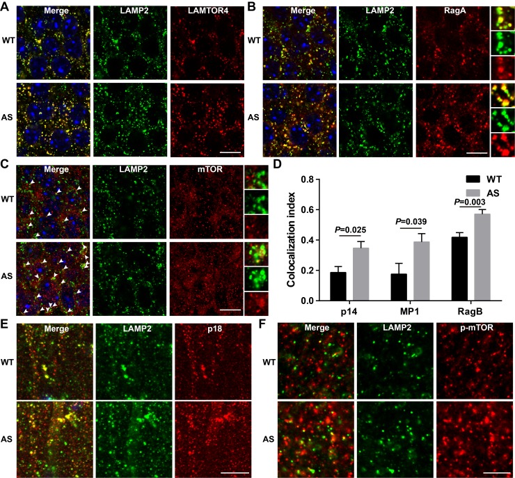 Figure 4—figure supplement 1.