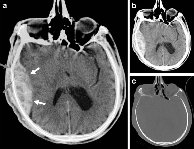 Fig. 7