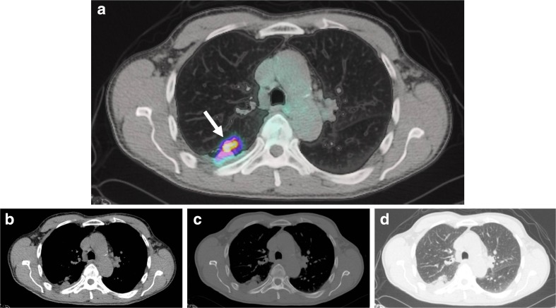 Fig. 11