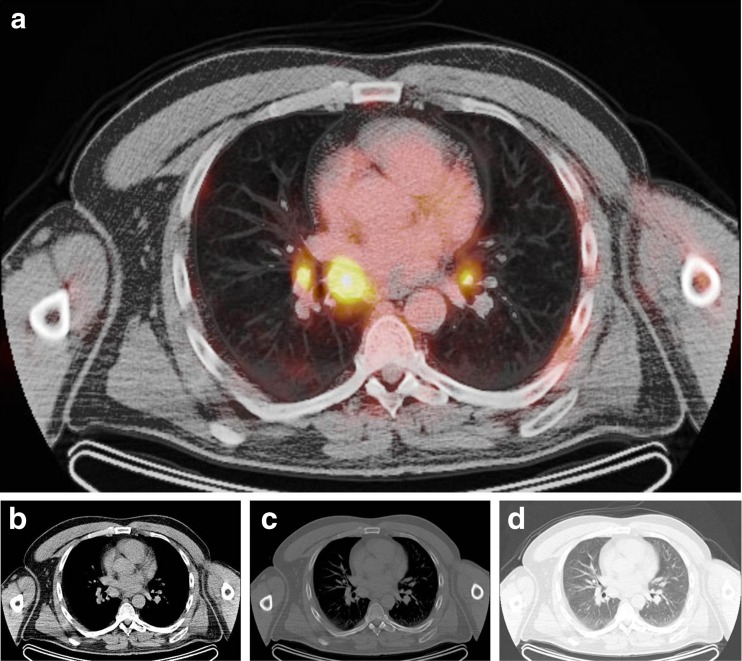 Fig. 10