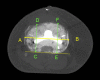 Fig. 5