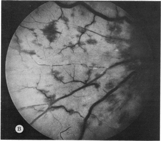 FIGURE 1 B