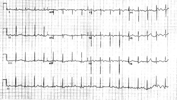 Figure 2  