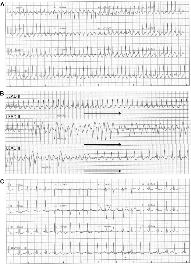 Figure 2