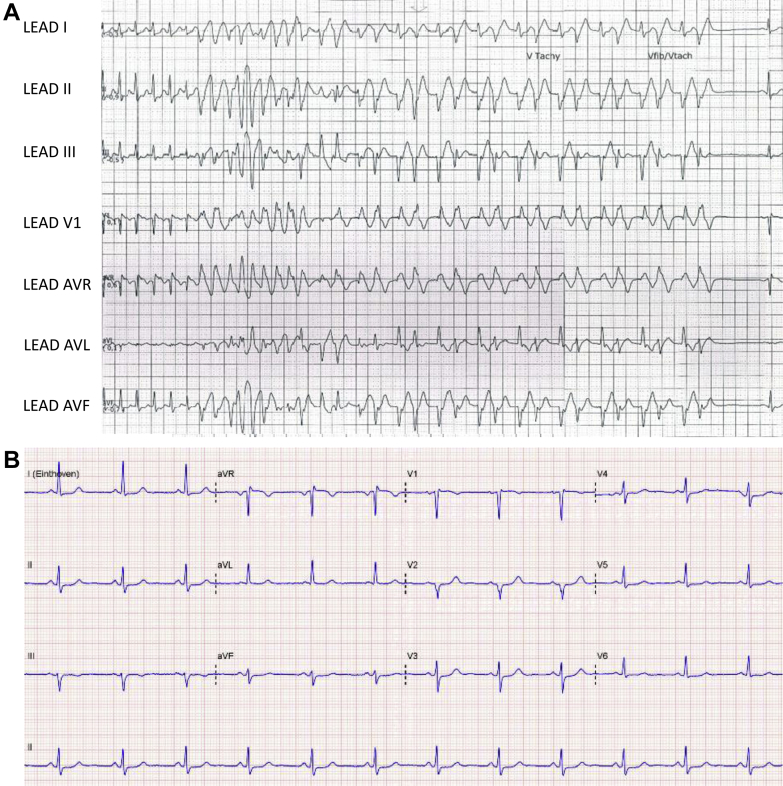 Figure 3