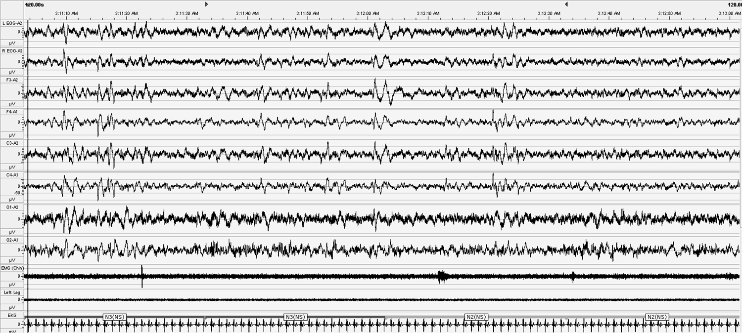 Fig. 1