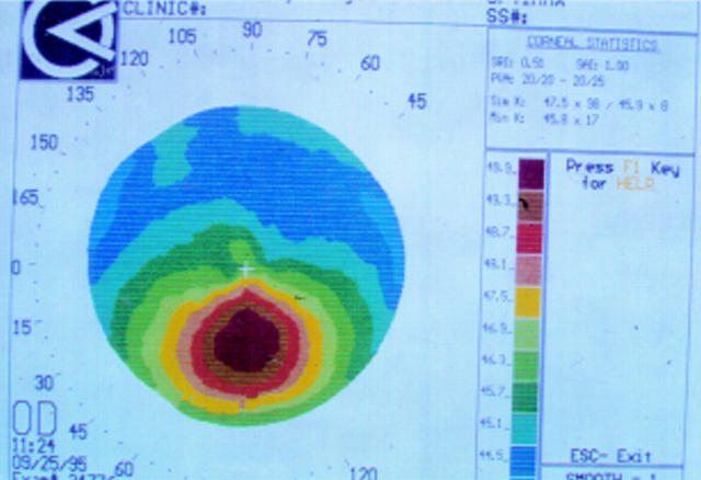 Figure 6  