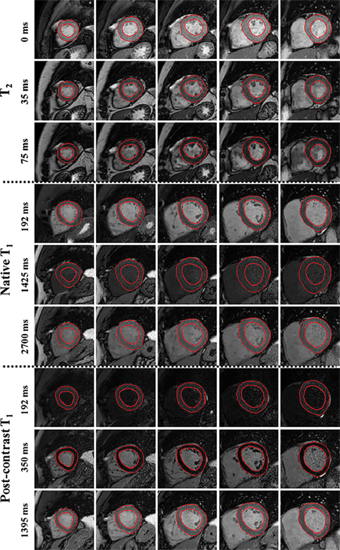 Figure 2: