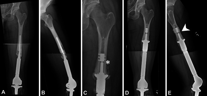 Fig. 1A–E