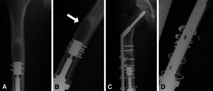 Fig. 4A–D