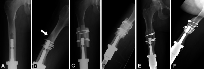 Fig. 5A–F