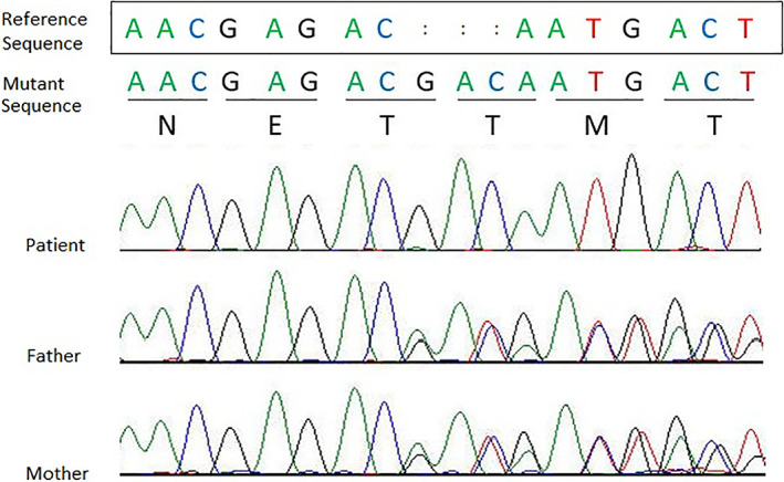 FIGURE 2