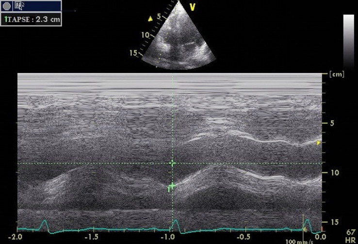 Fig. 2.