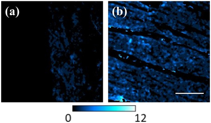 Fig. 11.