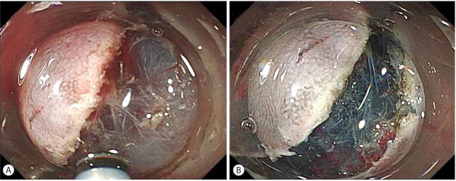 Fig. 6.